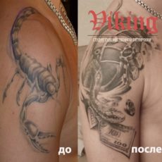 Исправление татуировок: до и после